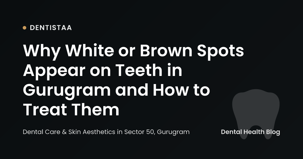 Why White or Brown Spots Appear on Teeth in Gurugram and How to Treat Them