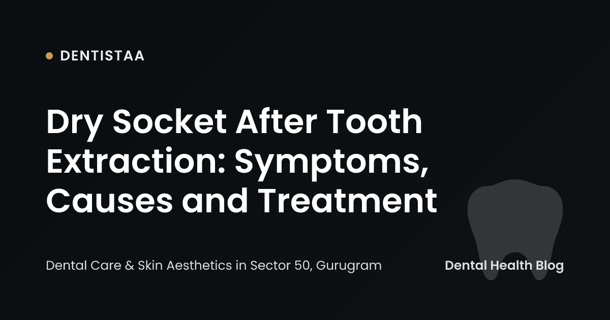 Dry Socket After Tooth Extraction: Symptoms, Causes and Treatment